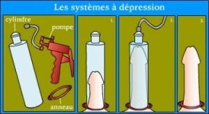 sexualite prostate - vacuum penis