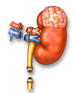 néphrectomie totale