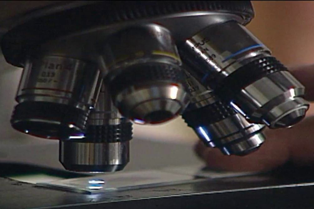 Dépistage individualisé du cancer de la prostate