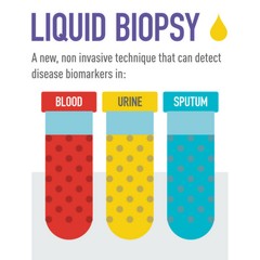 MDXHEALTH : lance le test de « biopsie liquide » SelectMDx aux Etats-Unis
