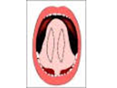 Prelevement tissus cavite buccale