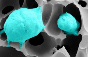 Cancer de la Prostate: Du cryogel en 3D pour suivre les cellules à la trace