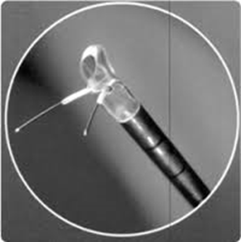 electrodes sous controle endoscopique