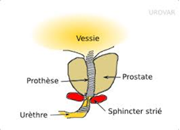 schema vessie et prostate