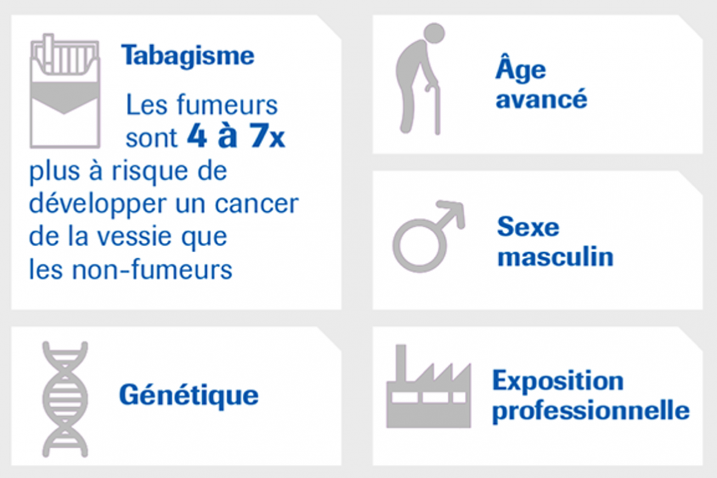 Facteurs de risque du cancer de la vessie