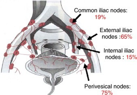 Ganglions lymphatiques régionaux