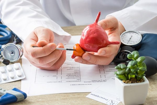Une nouvelle stratégie de traitement contre le cancer de la prostate résistant aux médicaments