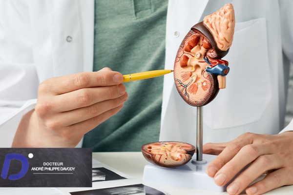 Carcinome papillaire du rein