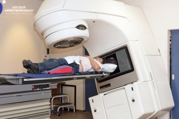 les bénéfices de la radiothérapie hypofractionnée après la chirurgie du cancer de la prostate