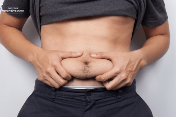 Facteur de risque prévisible du cancer prostate: L’Adiposité et le risque d&rsquo;augmentation de décès