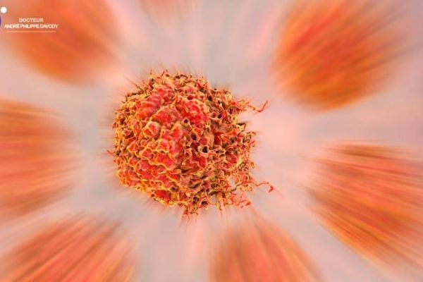 Découverte et impact de la protéine kinase 2 et espoir de traitement des métastases du cancer de prostate
