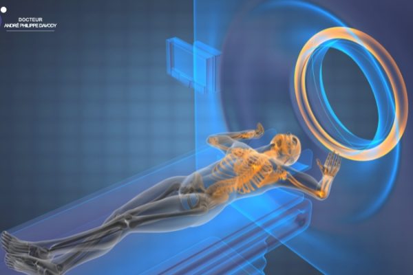 Les avantages de l’IRM multiparamétrique pour prévenir les biopsies répétées pendant la surveillance active